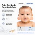Common baby skin problems caused by harsh cleansers